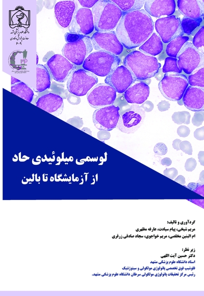 لوسمی میلوئیدی حاد: از آزمایشگاه تا بالین